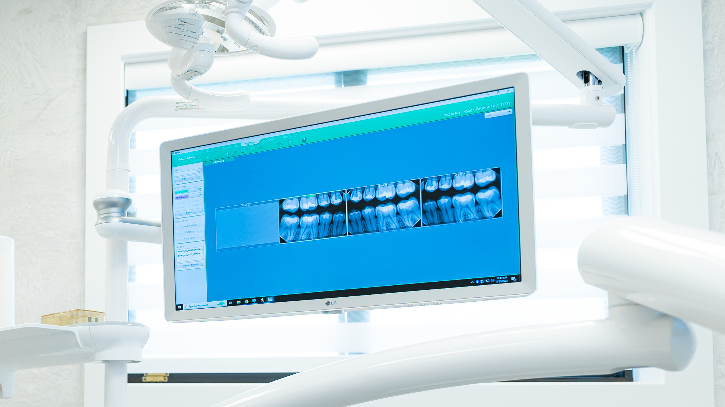 Ramsey Digital dental x-rays on a flat screen monitory