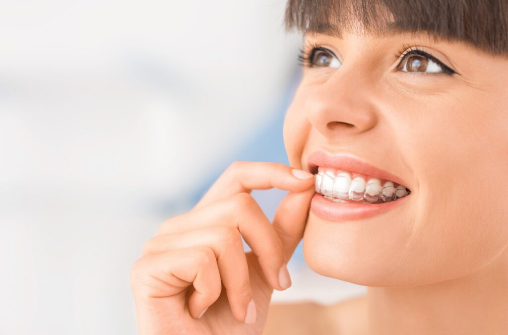 How to get Invisalign | Steps and Consultations