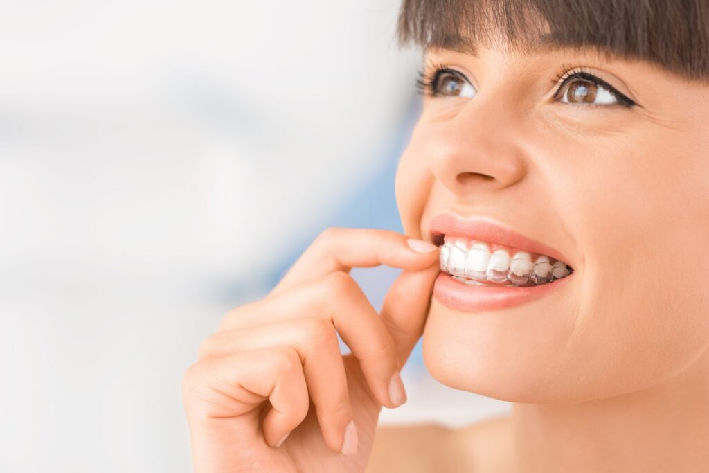 How to get Invisalign | Steps and Consultations