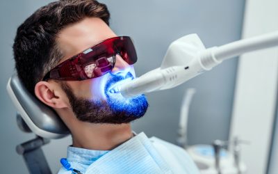 Laser Teeth Whitening Benefits: A Brighter Smile